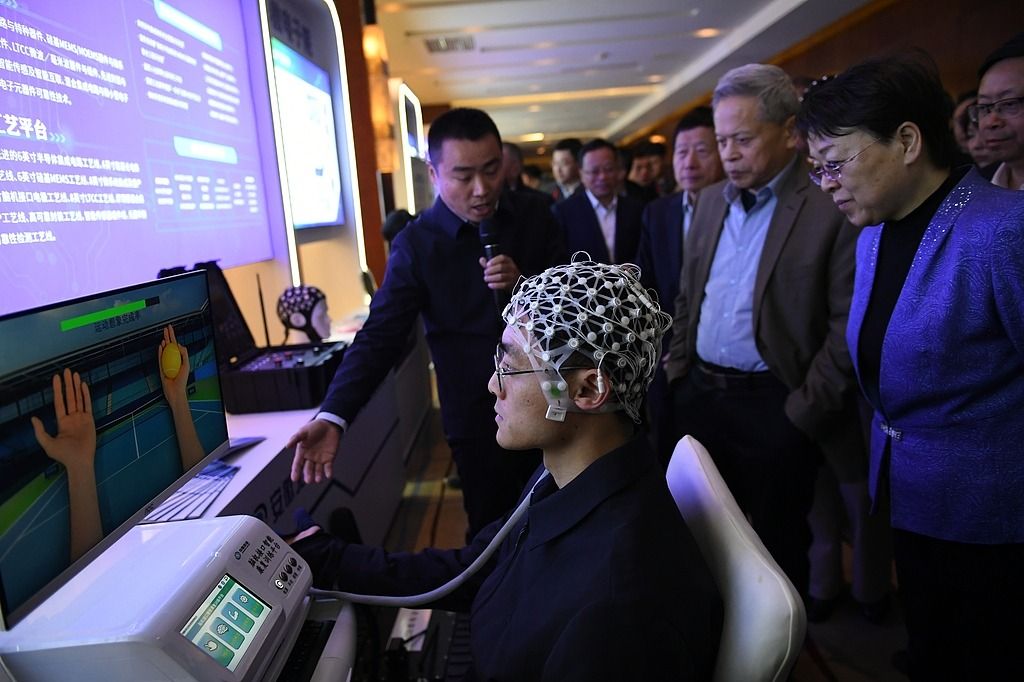 Innovative tech holds key to brain rehab - Chinadaily.com.cn